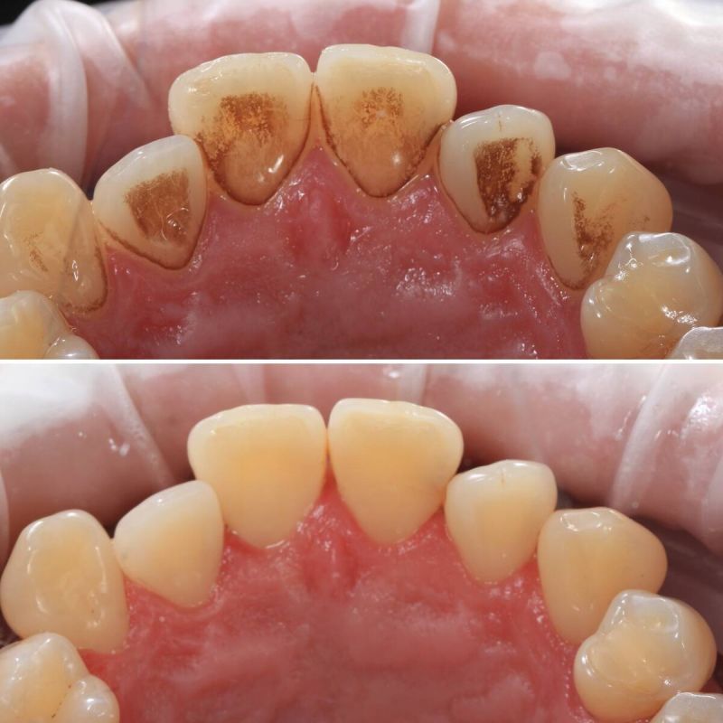 ��� ����� �� ���������� ������ �� ����� � ��� ��� ��������?